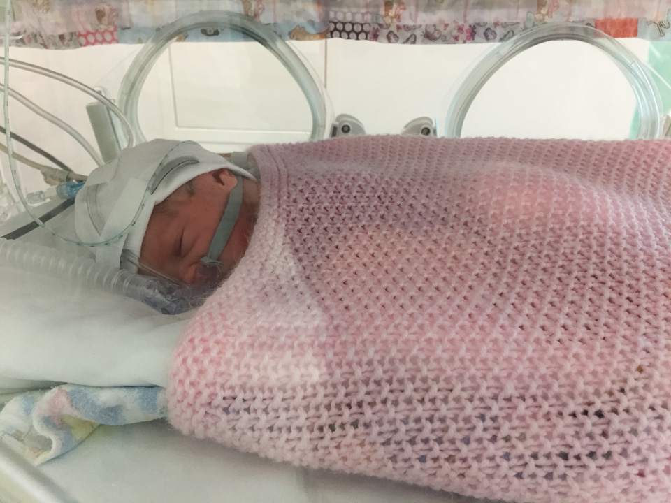 Twin born prematurely in special care baby unit